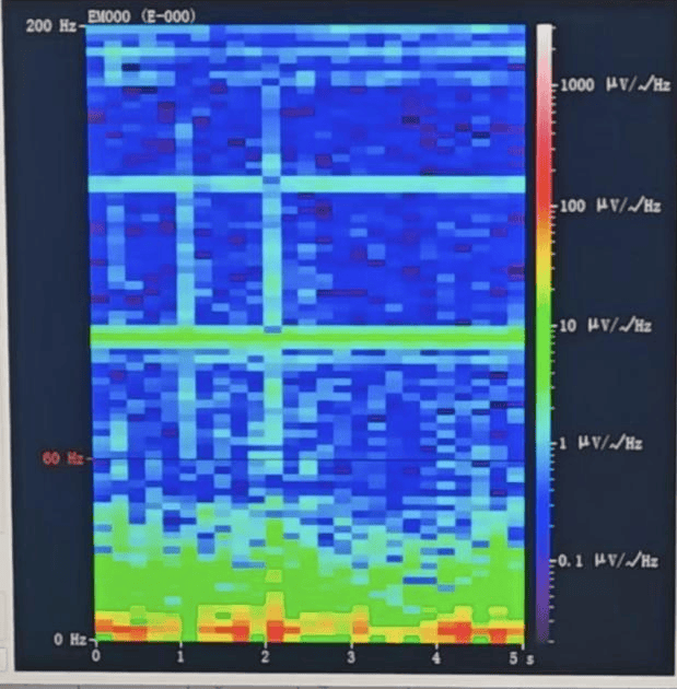 皇冠信用网会员_山西首例皇冠信用网会员！山西省人民医院成功实施脑机接口辅助功能区脑肿瘤切除手术